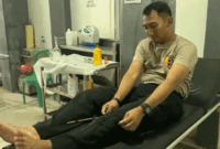 Kapolres Tual AKBP Whansi Des Asmoro terluka kena panah. dok Istimewa