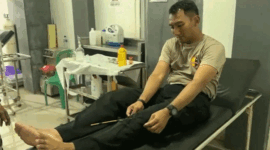 Kapolres Tual AKBP Whansi Des Asmoro terluka kena panah. dok Istimewa