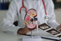 Foto ilustrasi: Getty Images/Nadzeya Haroshka