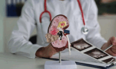 3 Bahan Alami Ini Bisa Bantu Bersihkan Ginjal, Racun Auto Keluar