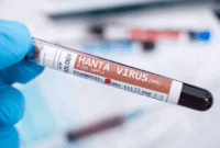 Ilustrasi Hantavirus. Foto: Mauro Rodrigues/Shutterstock