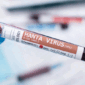 Ilustrasi Hantavirus. Foto: Mauro Rodrigues/Shutterstock