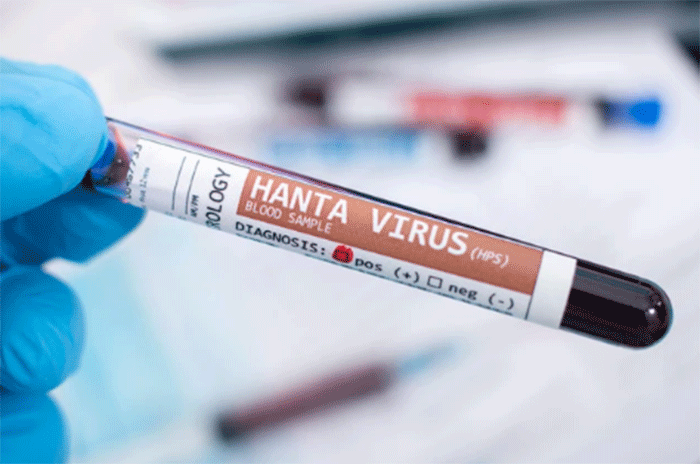 Ilustrasi Hantavirus. Foto: Mauro Rodrigues/Shutterstock